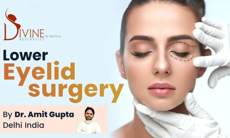 Blepharoplasty Surgery