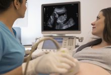 what-is-4d-ultrasound