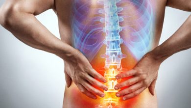 Sciatica