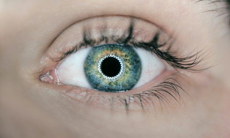 Glaucoma